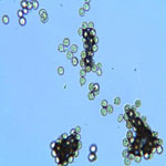 microscopic view of spores